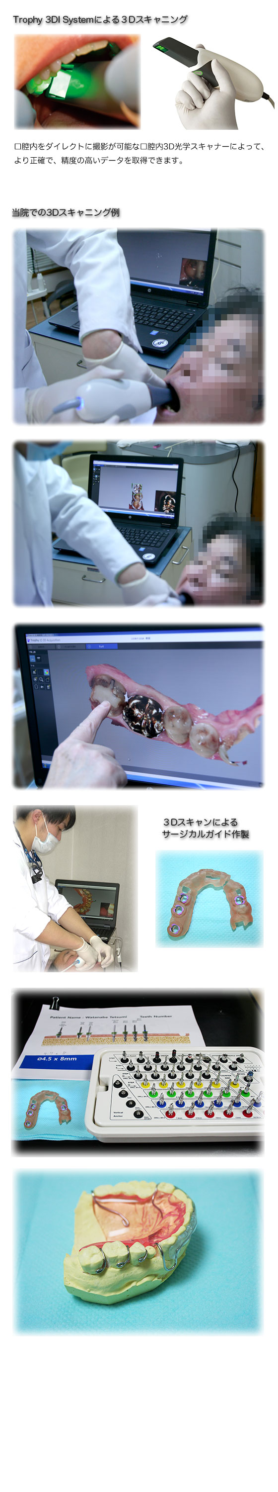 当院の３Dスキャニング